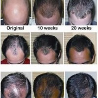 Hair-growth-Fertilizing-scalp-serum-for-men-59ml-0